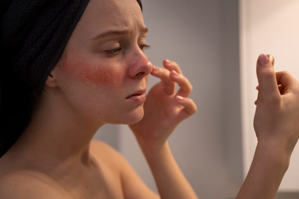 Rosacea Facial How to Reduce Redness and Treat Rosacea Without Harsh Medications 1 Rosacea Facial