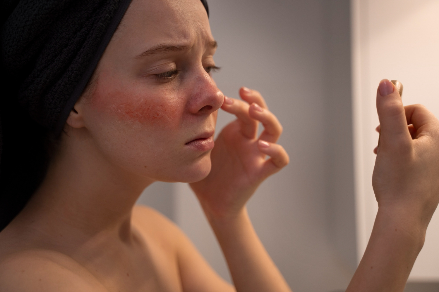 Rosacea Facial