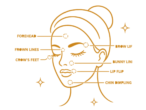 Botox Treatment Areas SkinLocal Miami FL Botox in Pinecrest Miami, FL 13 Botox Treatment in Pinecrest Miami