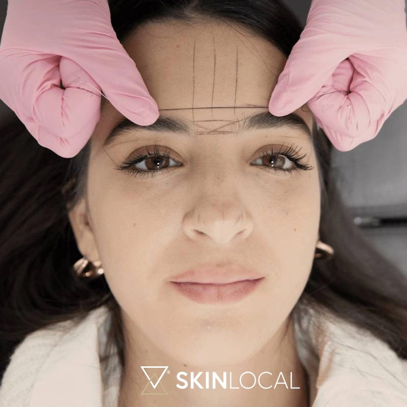 Brow Shaping SkinLocal Miami FL Botox Images Google Botox in Pinecrest Miami, FL 25 BROW SHAPING in Pinecrest, Miami, FL